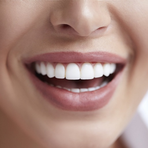 Flawless smile with metal free dental restoration