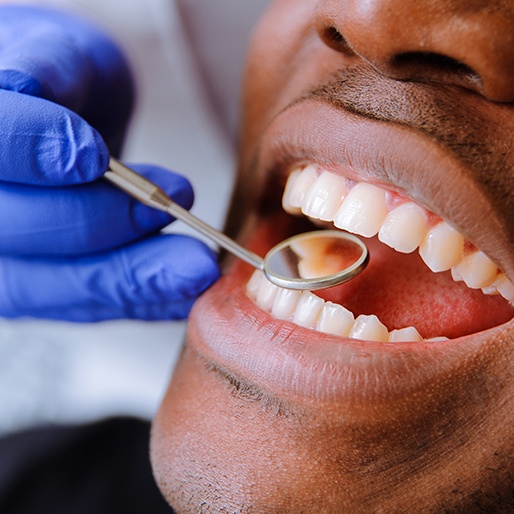 Dentist checking patient's tooth colored filling