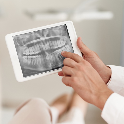 Dentist looking at digital x-rays on tablet computer